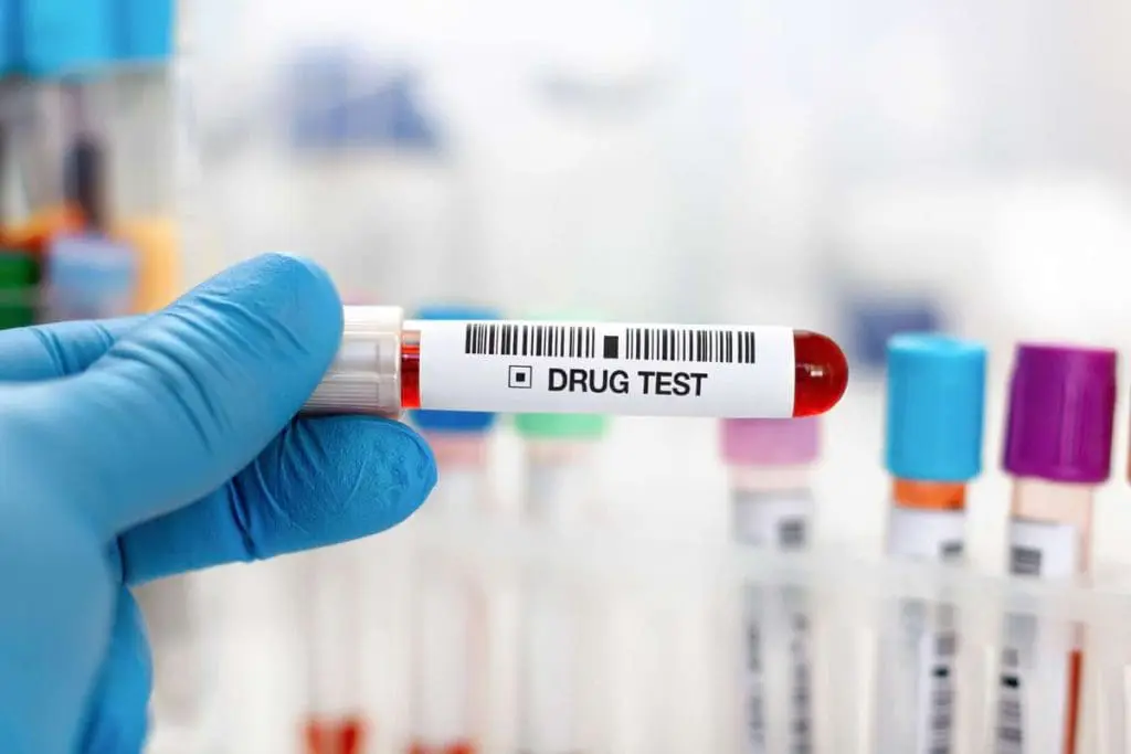 Hand in blue gloves holding a test tube labeled "drug test" for MRO analysis