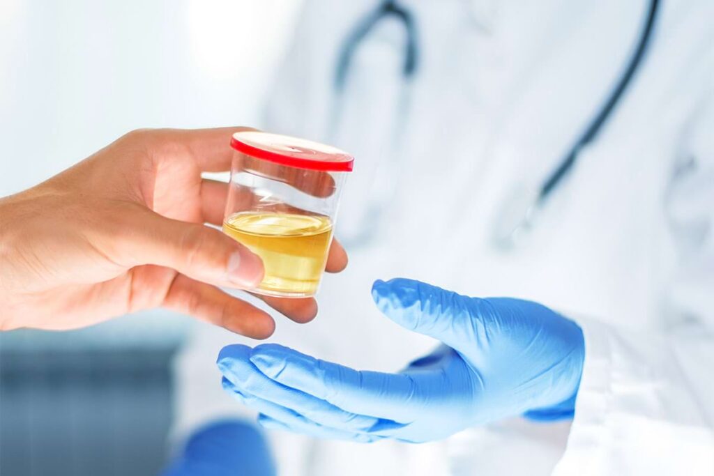 Person handing over a urine sample for a drug screen.